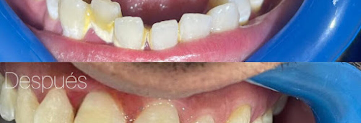 Dental World -Sede Caribe Plaza