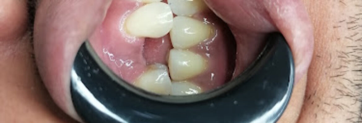 ASISTENCIA DENTAL INTEGRAL ISODENT