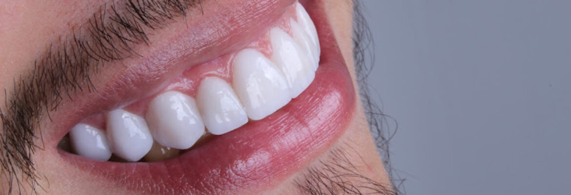 The Best Smile Cucuta