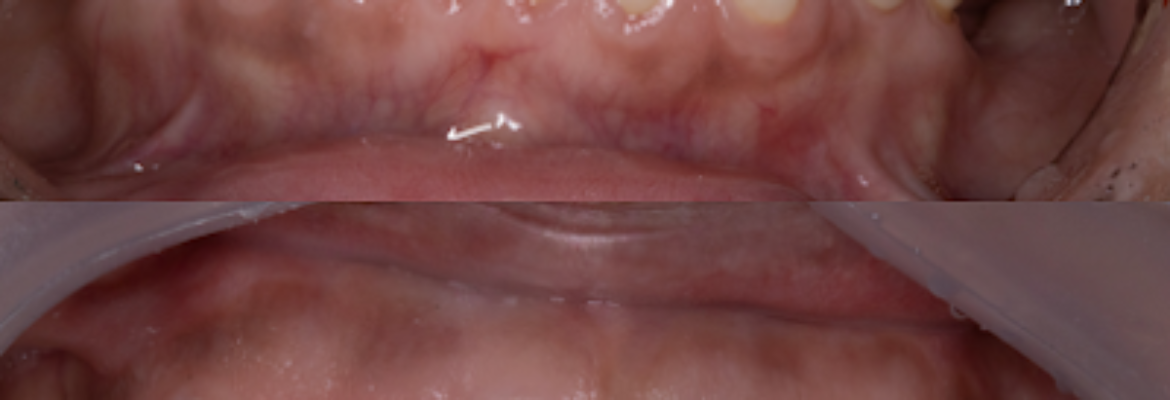 odontología dentals solutions – Implantes Dentales (Sede Villas de Granada)
