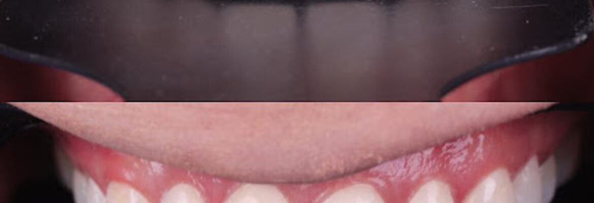 ORAL DESIGN BELEN
