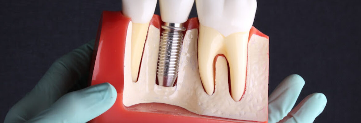 Odontología Premium – Dr. Angel Sanchez