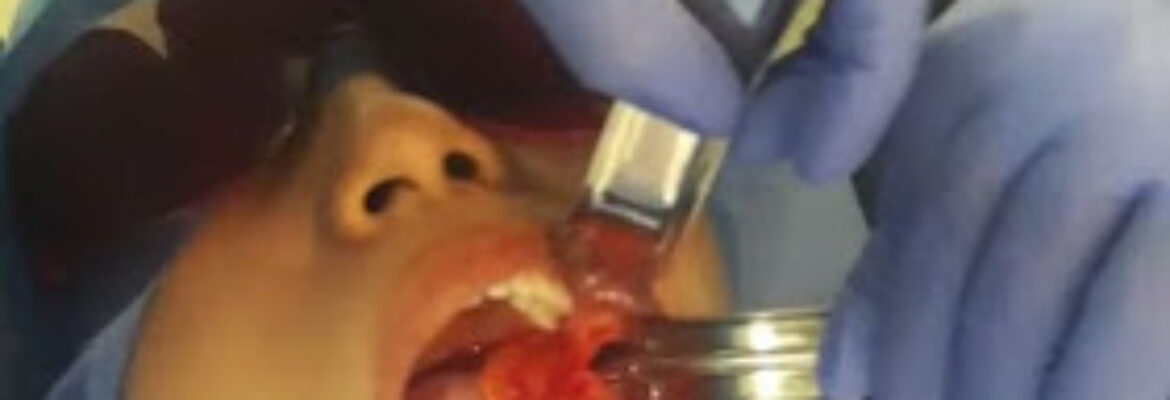Odontología Estetica e Implantologia Oral