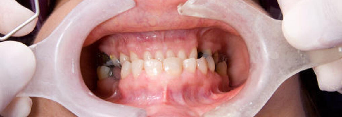 Gloria Helena Posada Gómez – Rehabilitación Oral